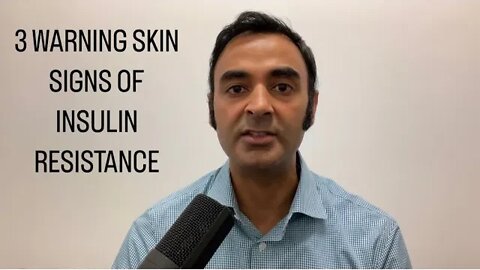 3 WARNING skin signs of INSULIN RESISTANCE (precursor to DIABETES)