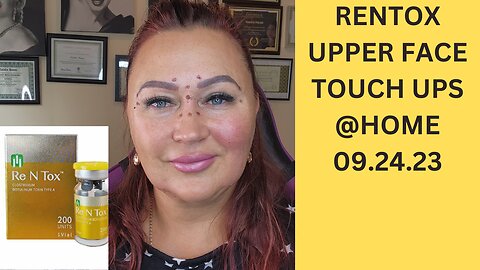 RENTOX UPPER FACE TOUCH UP @ HOME 9.24.23 #botox