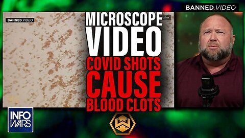 Microscope Video: Pathologist Proves COVID Shot Causes Blood Clots