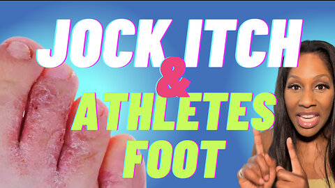 Jock Itch & Athlete's Foot: Prevention & Treatment. A Doctor Explains