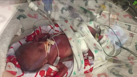 Colorado mother of micro-preemie baby to run 147 miles after son beats the odds