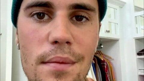 Justin Bieber shares update after revealing his face is partially paralyzed