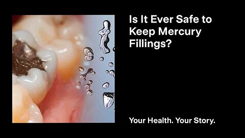 Is It Ever Safe to Keep Mercury Fillings?