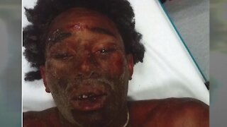 Riviera Beach police officers fired for body camera violations after suspect winds up beaten