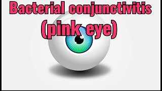 Bacterial conjunctivitis (pink eye)