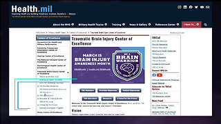 Acute Concussion Care Pathway Overview