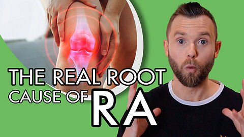 The Real Root Cause of Rheumatoid Arthritis