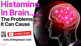 Is Excess Brain Histamine The Cause of Your Symptoms?