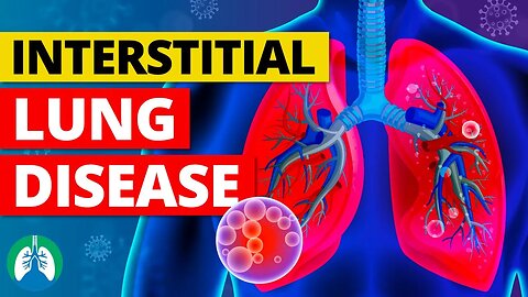 Interstitial Lung Disease (Medical Definition) | Quick Explainer Video