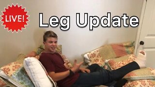 🔴 Leg Update