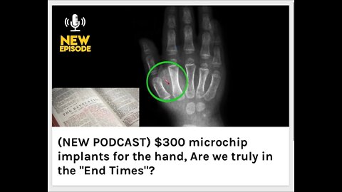 $300 microchip implants for the hand, Are we truly in the "End Times"?