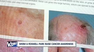 WKBW and Roswell Park spread skin cancer awareness