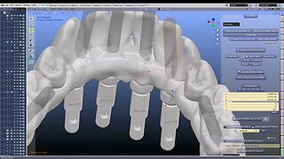 Making screw holes and angled screw holes through a hybrid