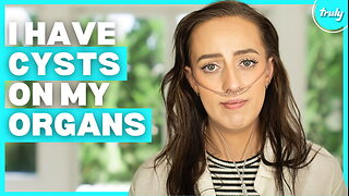 I Have 700 Cysts On My Lungs | BORN DIFFERENT