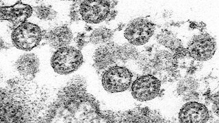 CDC Removes Guidance Update On Coronavirus Transmission