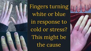 fingers turning white