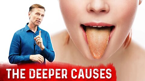 What Causes the Tongue to Change Colors?