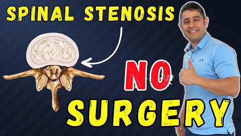 Chronic Lower Back pain due to spinal stenosis getting pain free without surgery