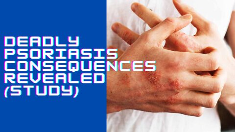 Deadly Psoriasis Consequences Revealed (Study)
