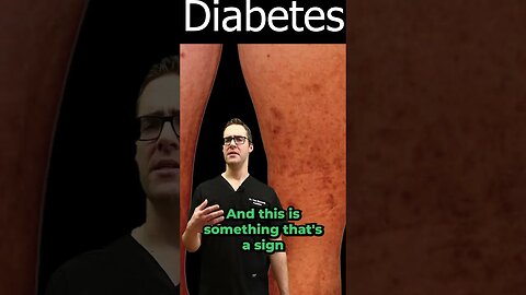 Diabetic Dermopathy Pictures & Treatment [Diabetes Symptoms & Signs]