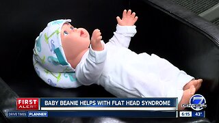 Baby beanie helps cure and prevent flat head syndrome