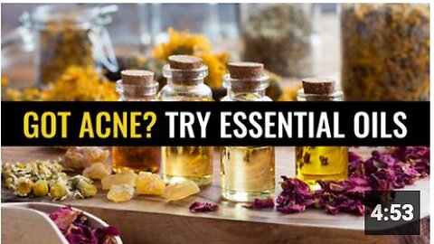 Got acne? Try essential oils