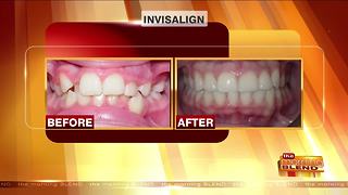 The Different Advancements in Modern Orthodontics