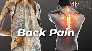 This Is What's Causing Your Back Pain