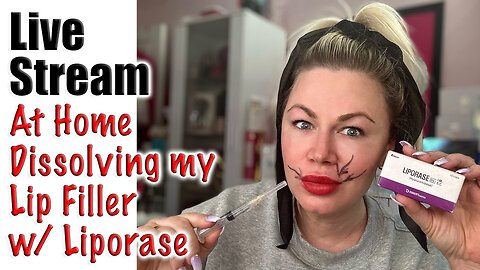 Dissolving Lip Filler At Home w/ Liporase from AceCosm ! Swelling Alert lol Code Jessica10 saves $