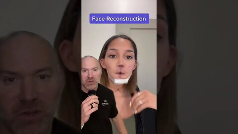 Reconstructing a Face After a Gunshot 😱 #shorts