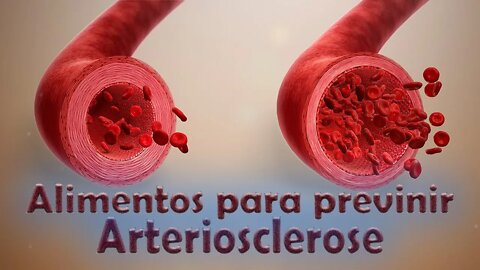 Dicas de alimentos saudáveis para evitar a arteriosclerose