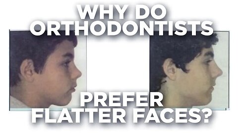Orthodontics flattens your face