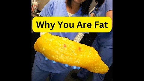 Why you are FAT