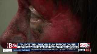 Adventist Health hosts burn support course