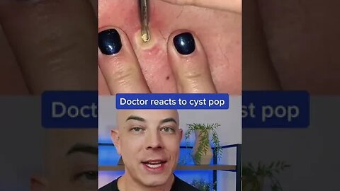 Doctor reacts to big cyst pop! #pimplepop #cystpop #dermreacts