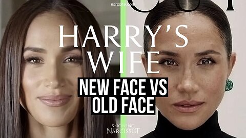 New Face Vs Old Face (Meghan Markle)