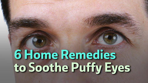 6 Home Remedies to Soothe Puffy Eyes