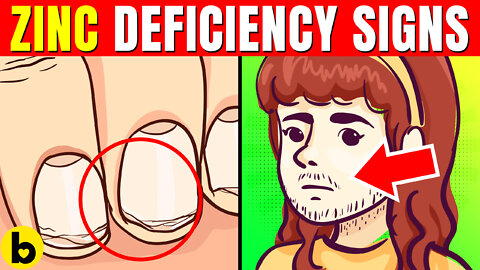 16 Signs & Symptoms Of Zinc Deficiency