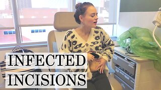 My Incision is Infected | Let's Talk IBD