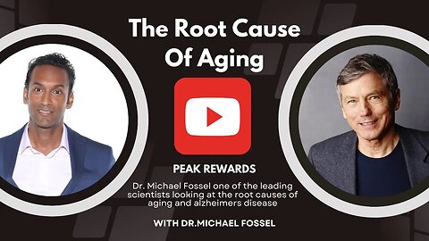 The Root causes of Aging SV