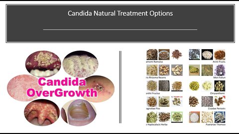 Candida Natural Treatment Options with Herbs & Supplements