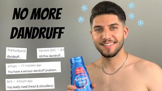 How I Got Rid Of My Dandruff/Seborrheic Dermatitis In 1 Week