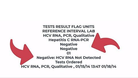 Hepatitis C RNA PCR - NEGATIVE