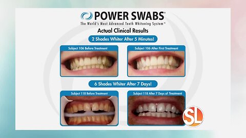 Let Power Swabs power a whiter, brighter smile!