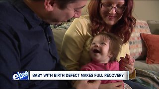 Cleveland Clinic doctors operate on 4-day old baby diagnosed with rare birth defect