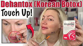 Dehanox (Korean Botox) Touch up! Code Jessica10 saves you Money!