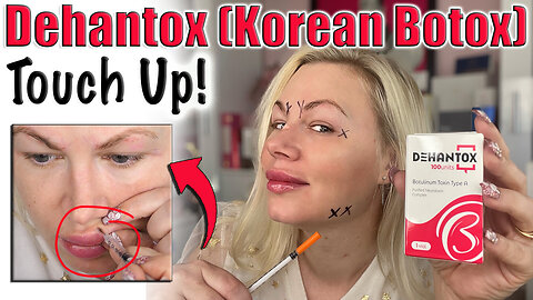 Dehanox (Korean Botox) Touch up! Code Jessica10 saves you Money!