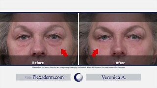 Want to instantly look younger? Try Plexaderm!