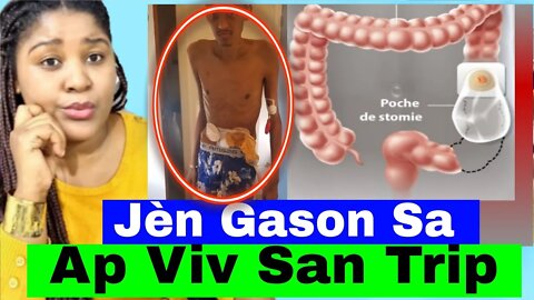 Sézisman Chok.. VideO Yon Jèn Gason Kap Viv San Trip (intestin)