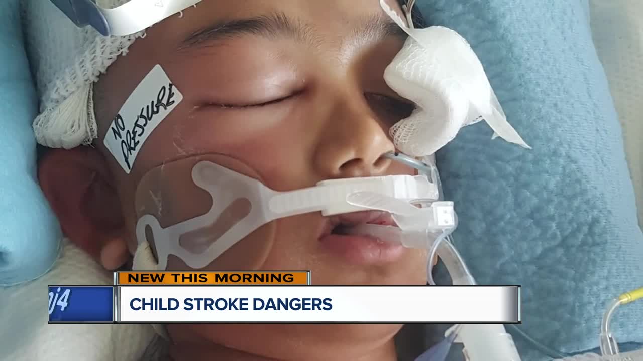 What parents need to know about child strokes